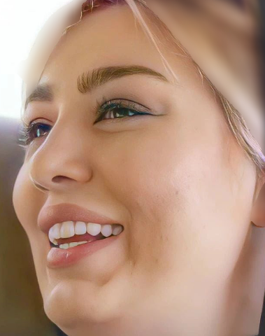 سحر قریشی چقدر جذاب و زیبا بود! + عکس قبل از عمل‌های عروسکی