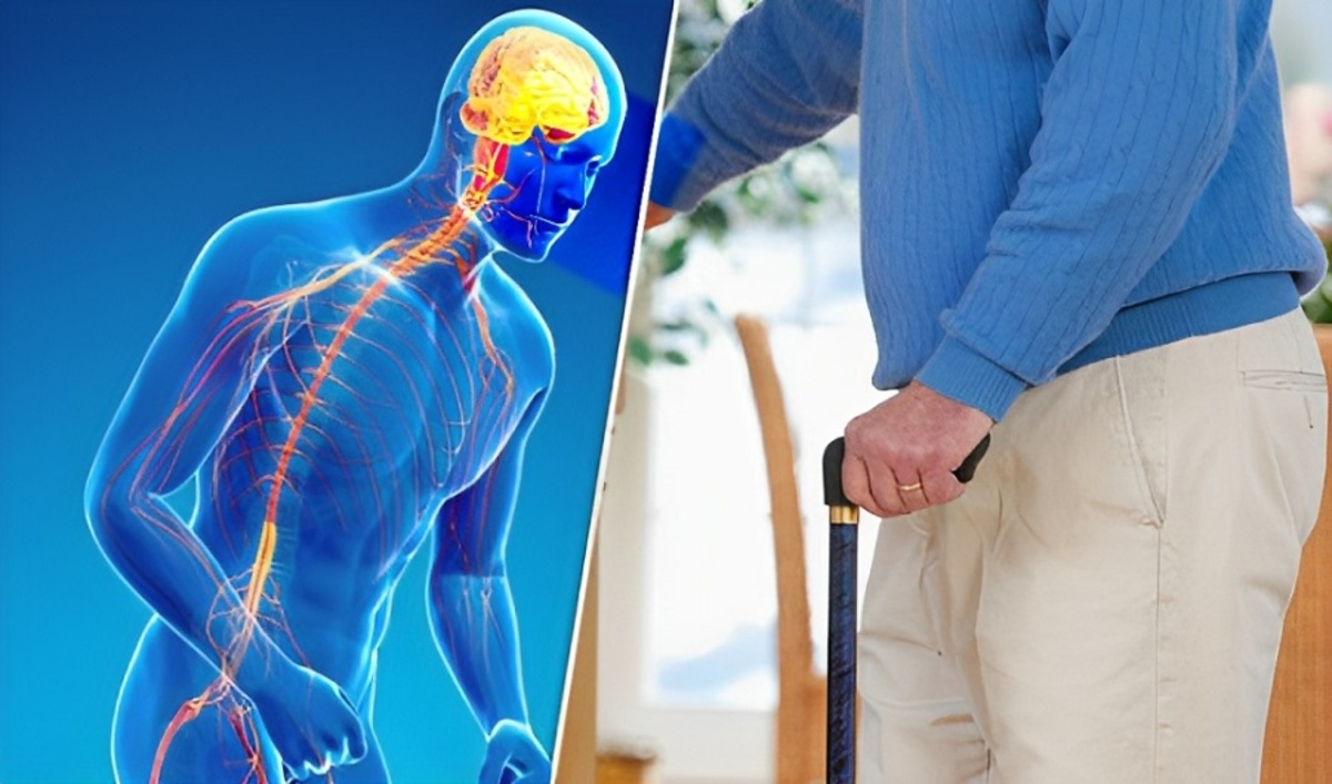 ایمپلنت‌های نخناعی، معجزه‌ای در زندگی بیماران پارکینسون