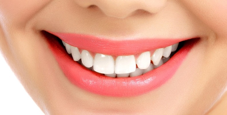 روش‌های درمان و پیشگیری از لکه‌های دندان چیست؟