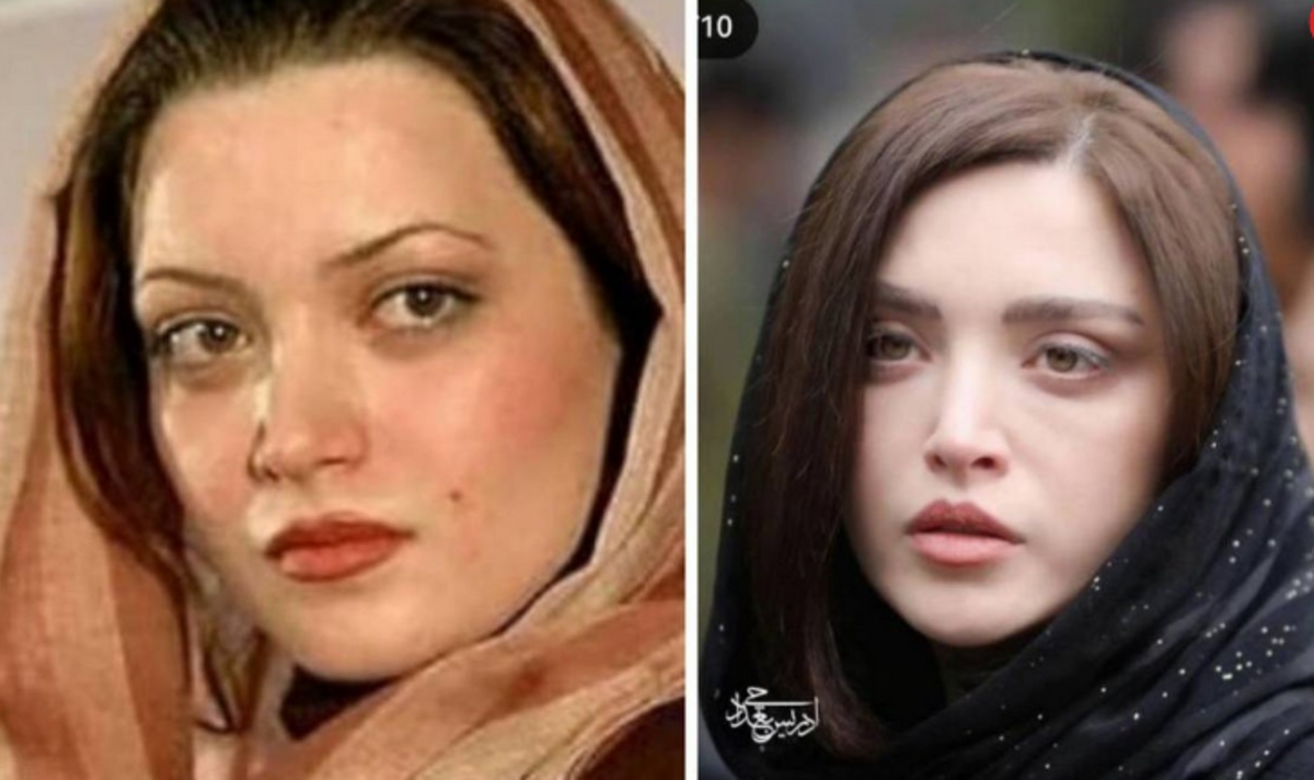 عکس‌های منتشر شده از سیر پلنگ شدن خانم بازیگر! /چهره اش را قبل از عمل‌های زیبایی اش ببینید!
