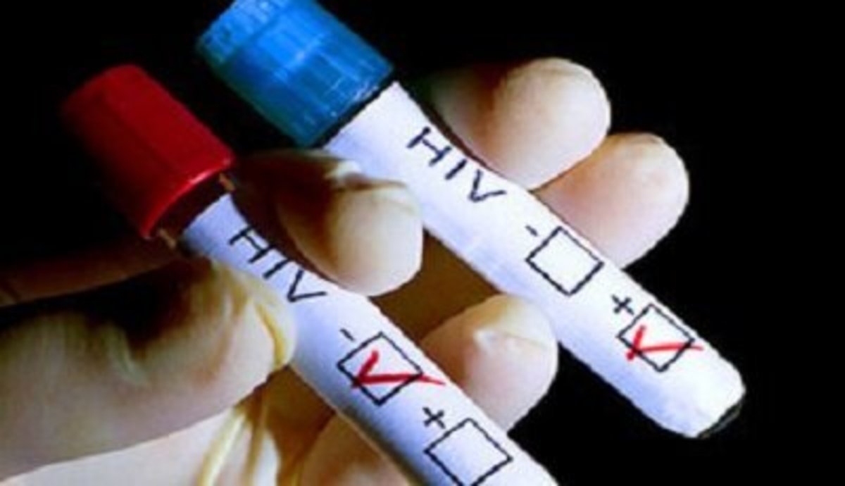 حمایت از مبتلایان HIV؛ گامی برای حذف بیماری