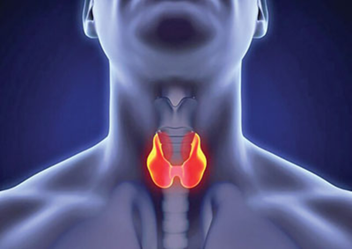 مبتلایان به تیروئید در معرض زوال عقل هستند؟