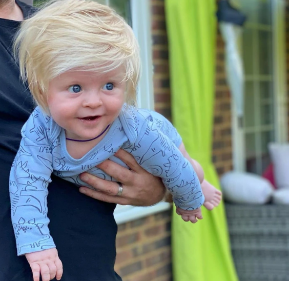 این نوزاد با مو‌های منحصربفردش به پدیده جذاب انگلیس تبدیل شد