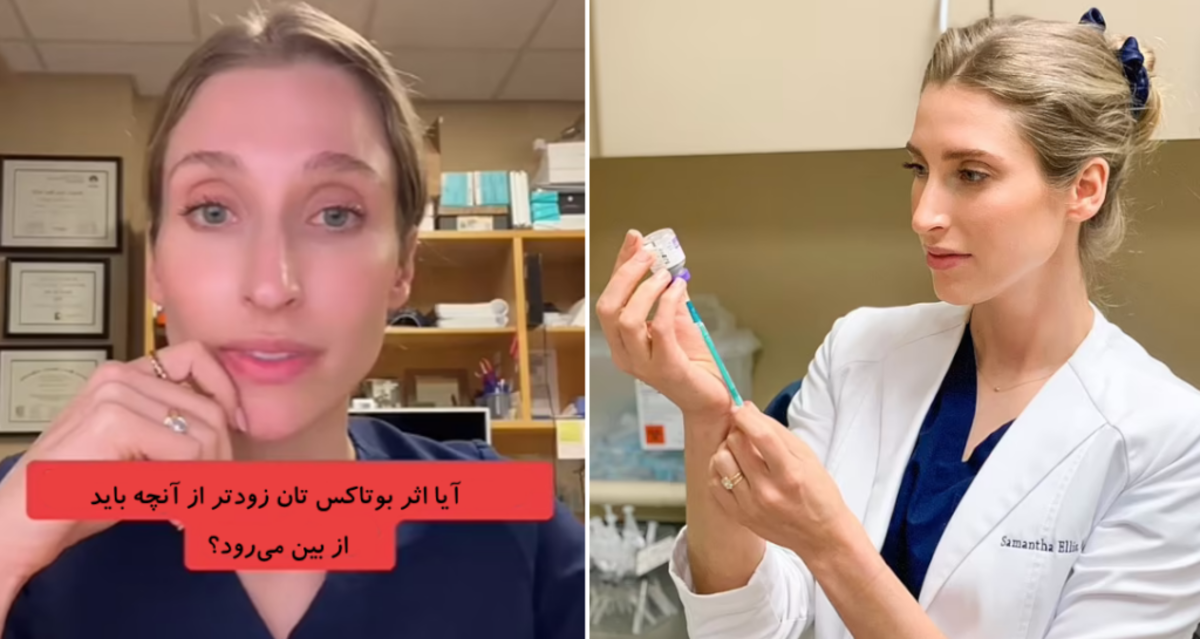 همه چیز درمورد بوتاکس از زبان یک متخصص