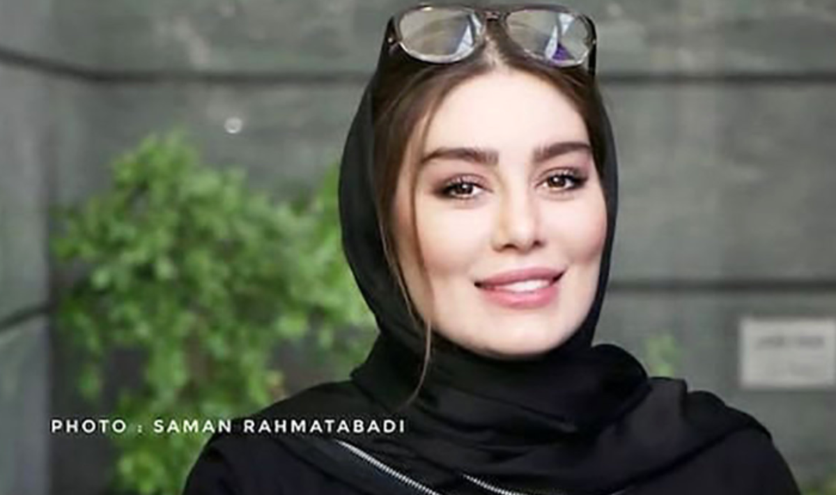 جدیدترین عکس منتشر شده از سحر قریشی شوکه تان می‌کند! /وضعیت صورتش نگران کننده است!