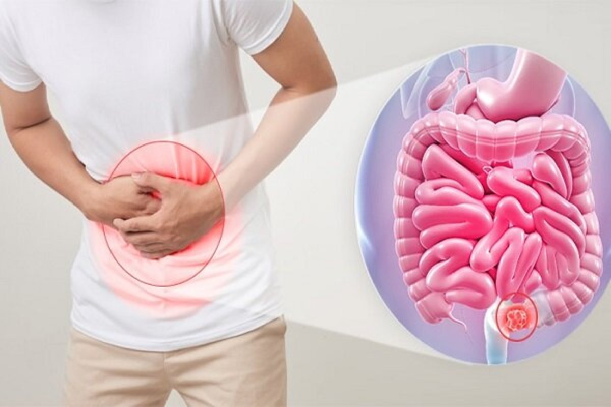 سبزیجات با مقدار زیادی آب و فیبر مناسب برای رفع سریع یبوست