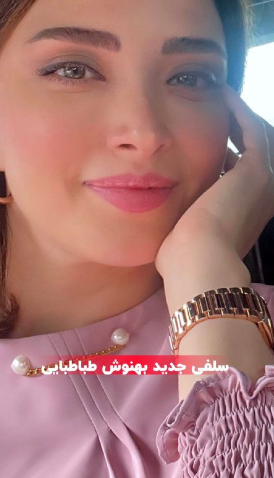 عکس از جزییات عمل‌های زیبایی بهنوش طباطبایی!