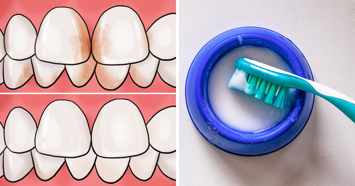 حتی فکرش را نمی‌کنید این کار‌ها باعث خراب شدن دندان هایتان بشود