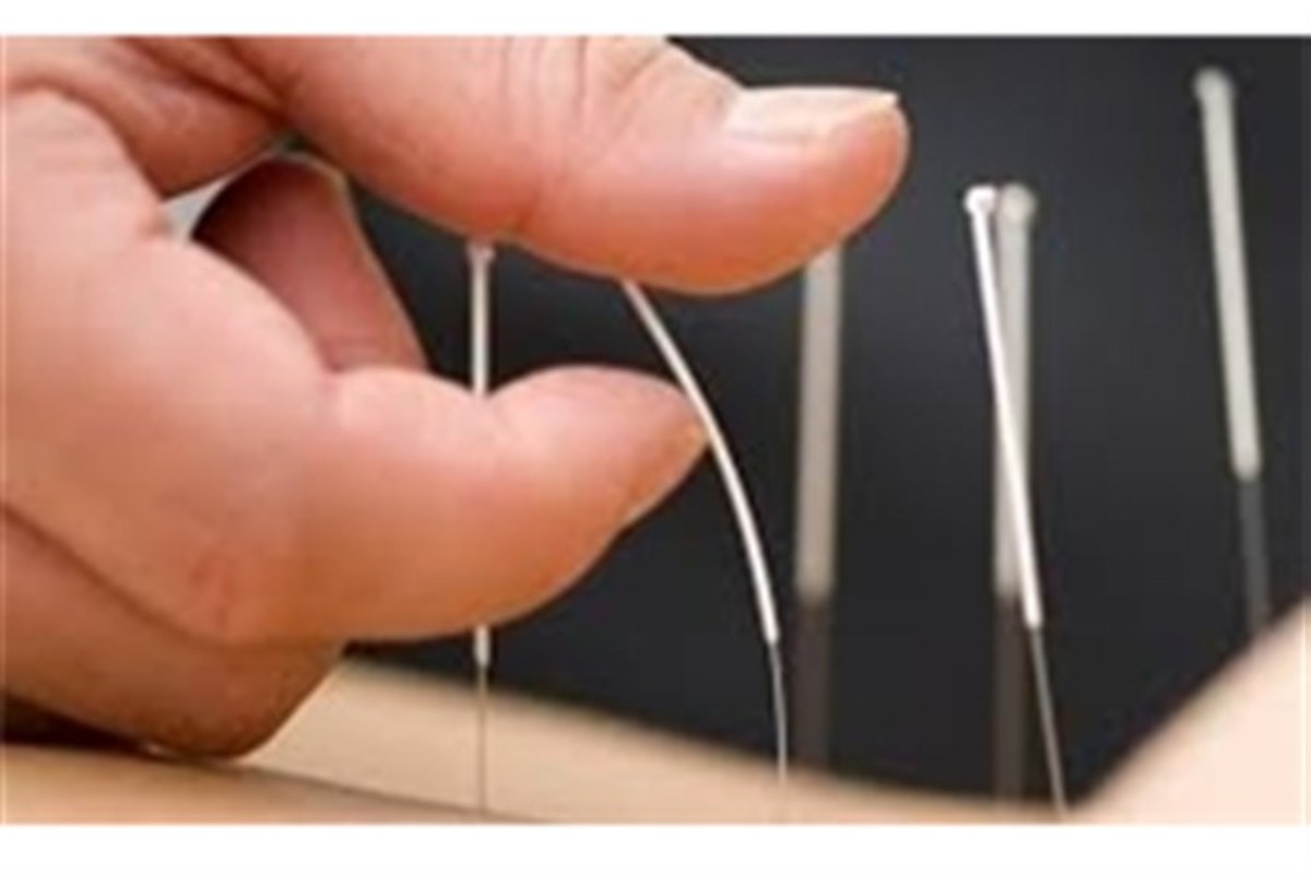 طب سوزنی چه زمانی کاربرد دارد؟