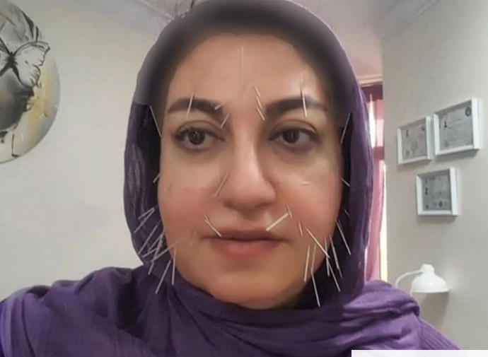این همه سوزن توی صورت خانم مجری چیکار میکنه؟! /اگر حالتون بد میشه نبینید!