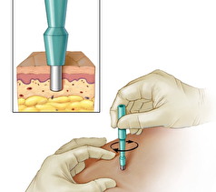 عمل جراحی سرطان سینه به اسکن در طول جراحی مجهز میشود!