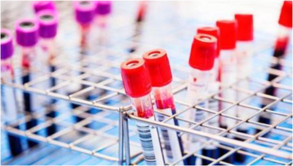 کشف جدید دانشمندان در راستای از بین بردن ویروس HIV