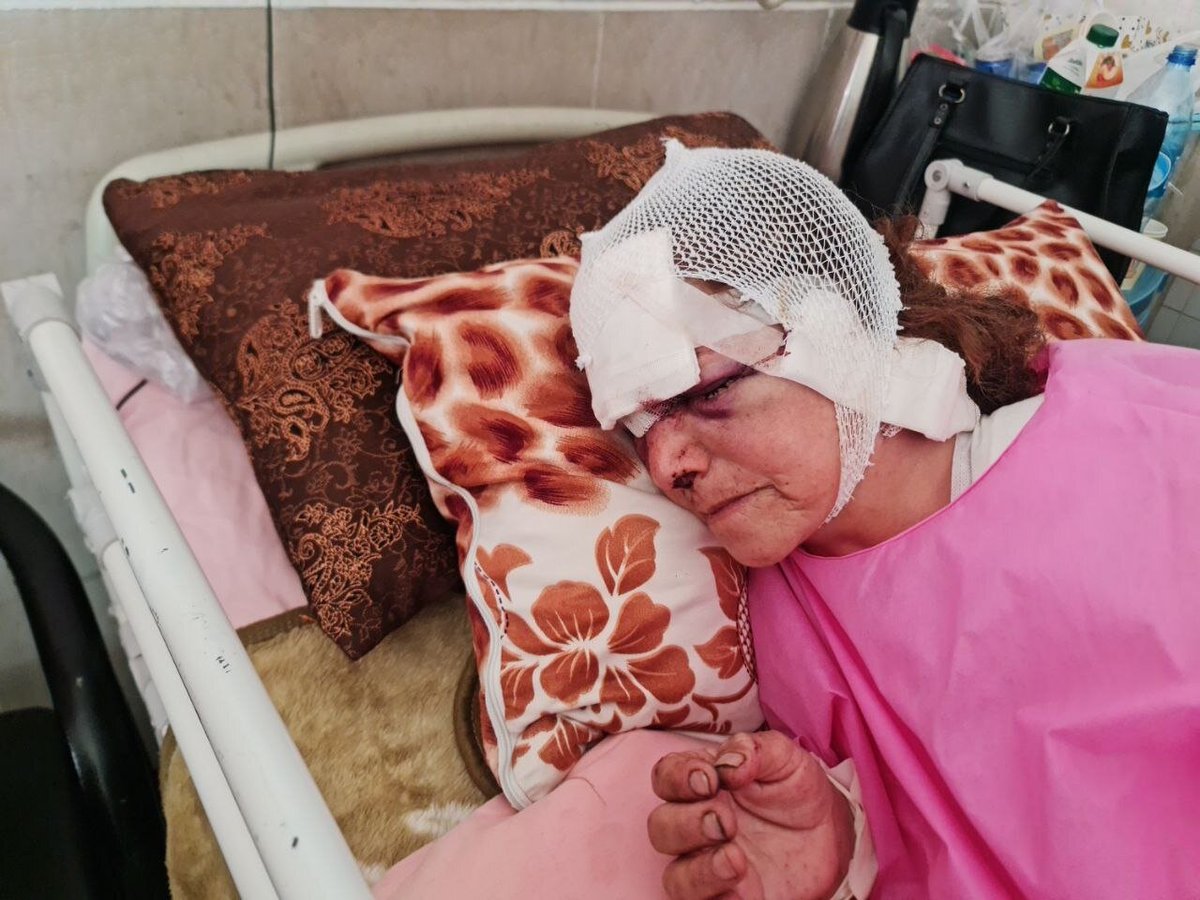 زن ۶۰ساله پیرانشهری با خرس سرشاخ شد!