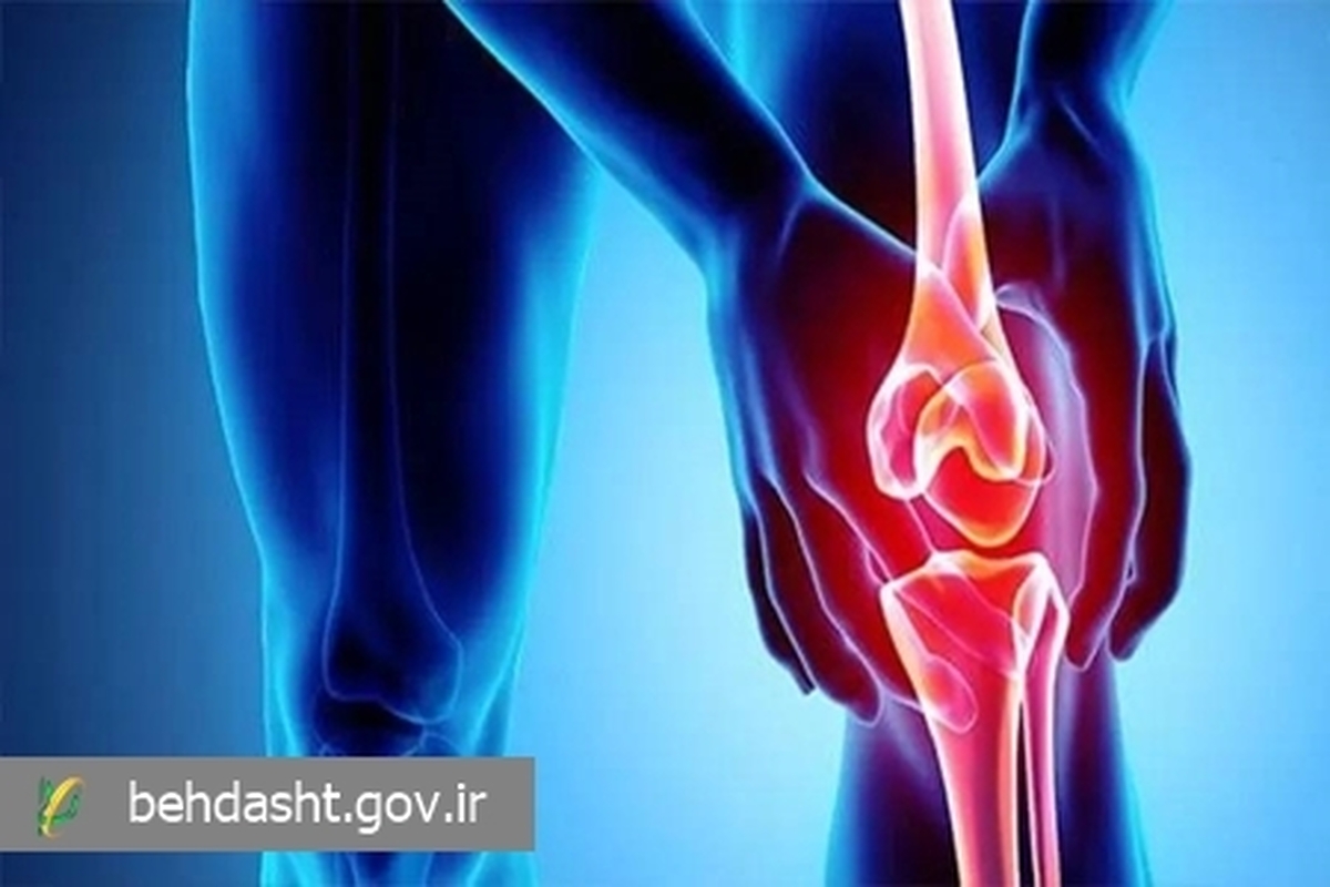 آشنایی با شایع‌ترین موارد بیماری آرتریت