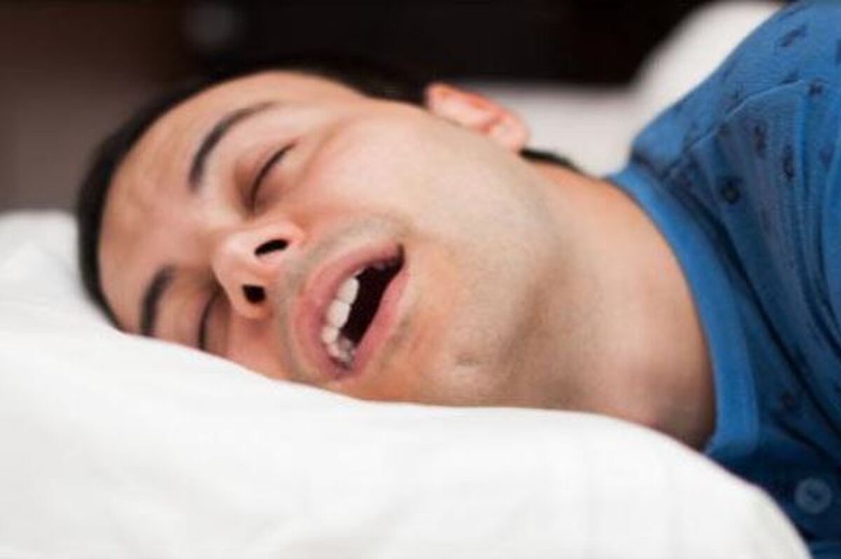 آپنه خواب موثر بر پیری مغز