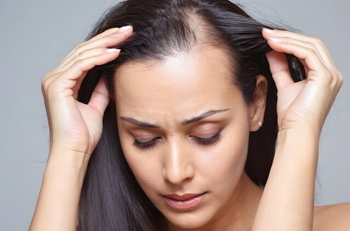 مکمل ضد ریزش اصل از کجا باید خرید؟