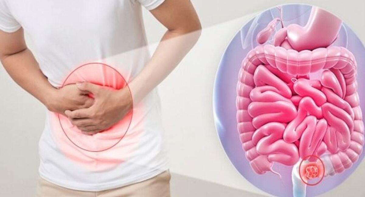 تاثیر مخرب استرس به سیستم گوارش