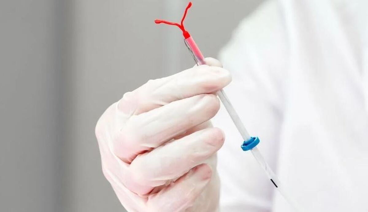 استفاده از IUD و تاثیرات آن بر سلامت جسم و روح