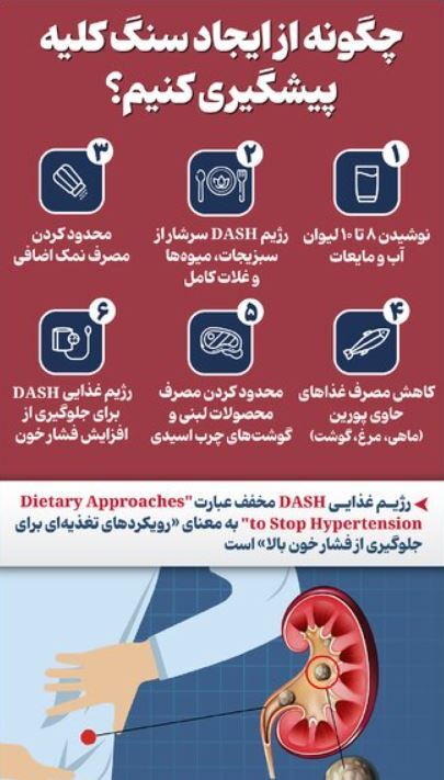 اقداماتی که مانع از تشکیل سنگ کلیه می‌شود