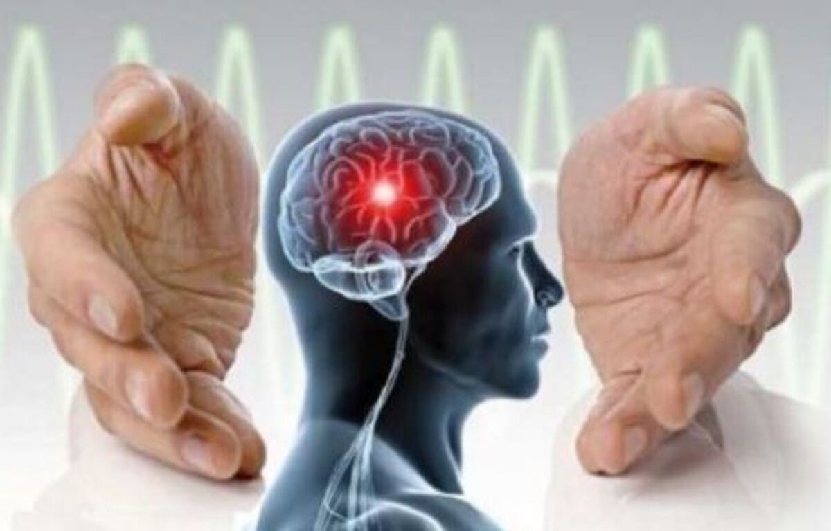 به این توصیه مهم عمل کنید تا دچار سکته مغزی نشوید