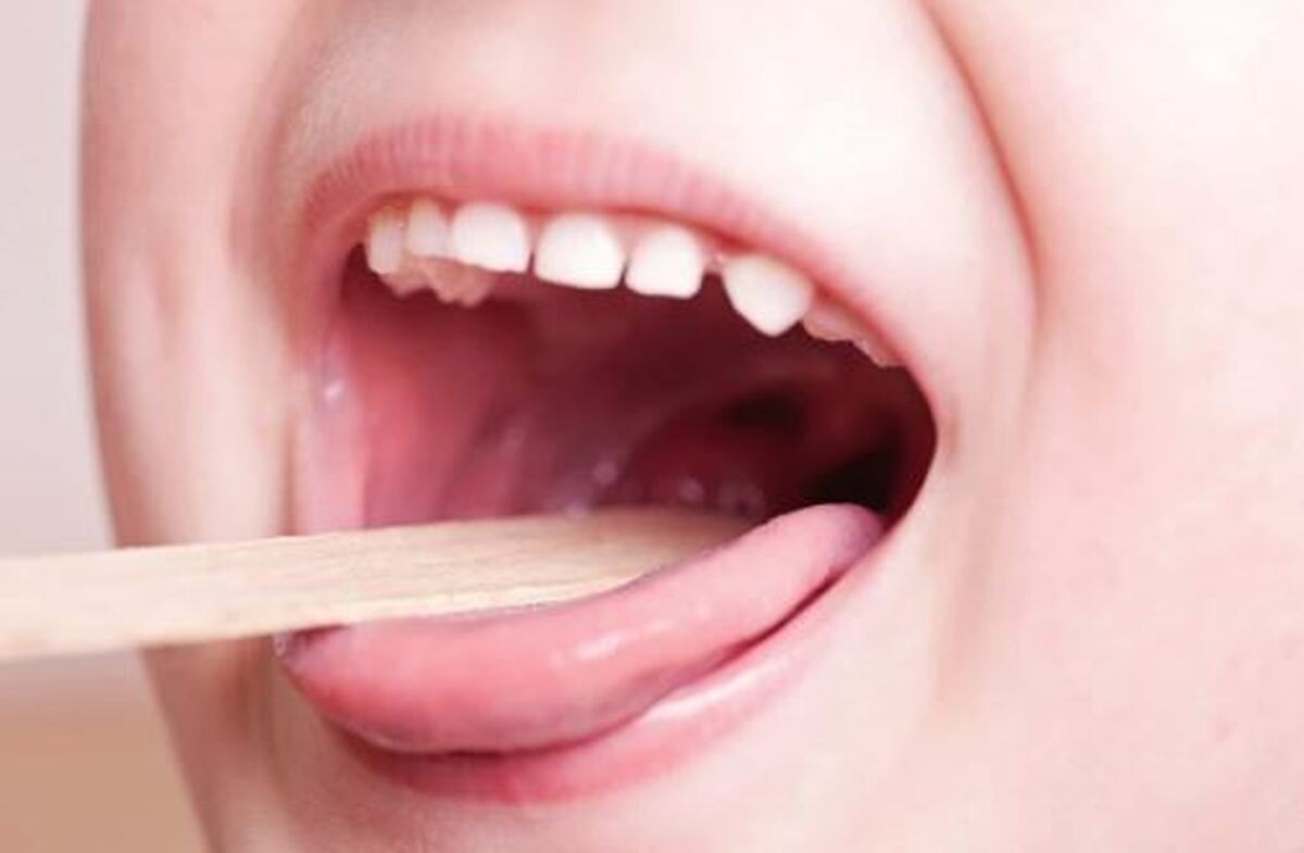رژیم غذایی و دارو‌های مناسب برای درمان گلودرد استرپتوکوکی