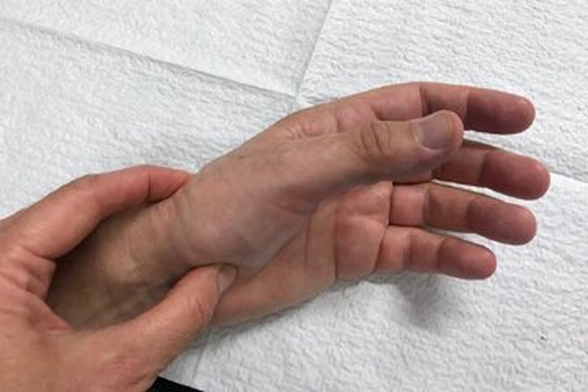 لرزش غیر ارادی انگشت شست نشانه چه مشکلاتی است؟