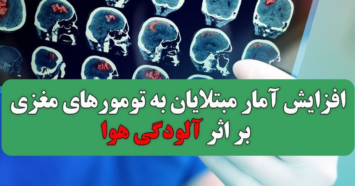 آلودگی هوا عاملی برای ابتلا به تومور‌های مغزی!