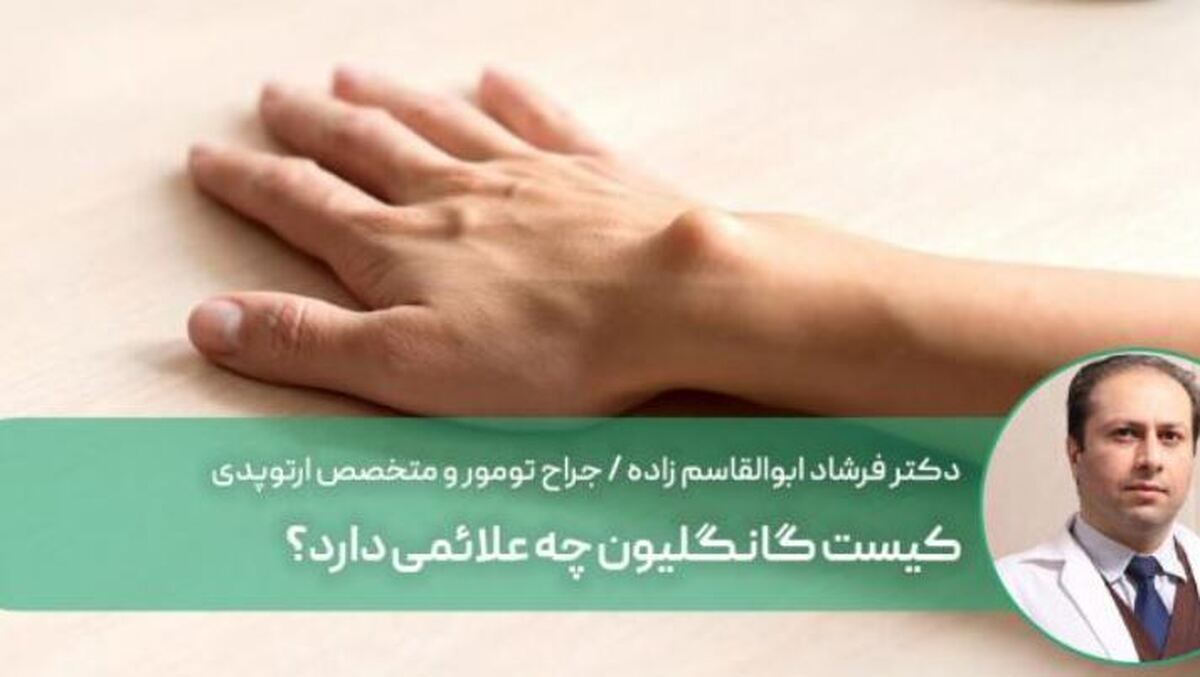 علائم ناشی از وجود کیست گانگلیون که باید بدانید!