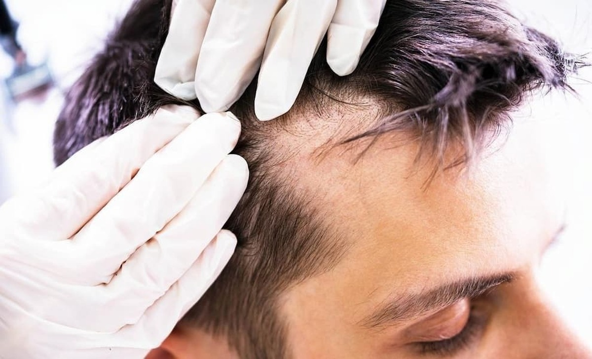 احتمال کاهش کاهش سرعت رشدمو با روزه گرفتن