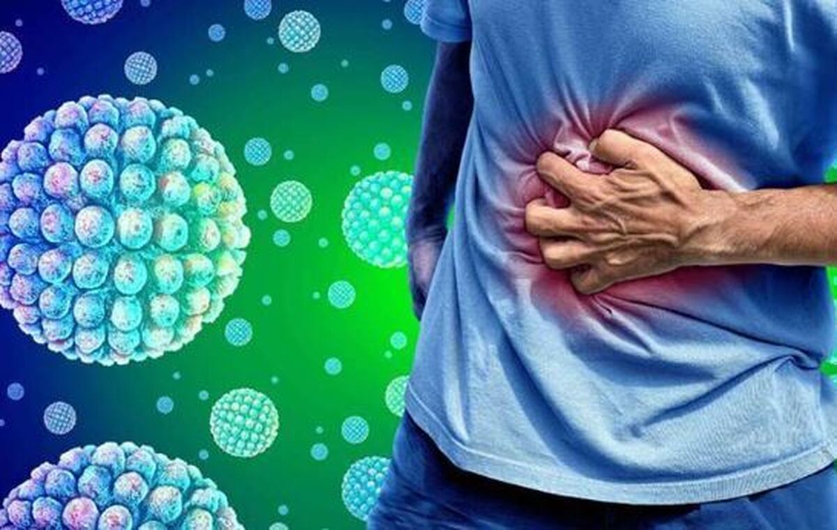 آنفلوانزای معده یا نوروویروس چه علائمی دارد؟