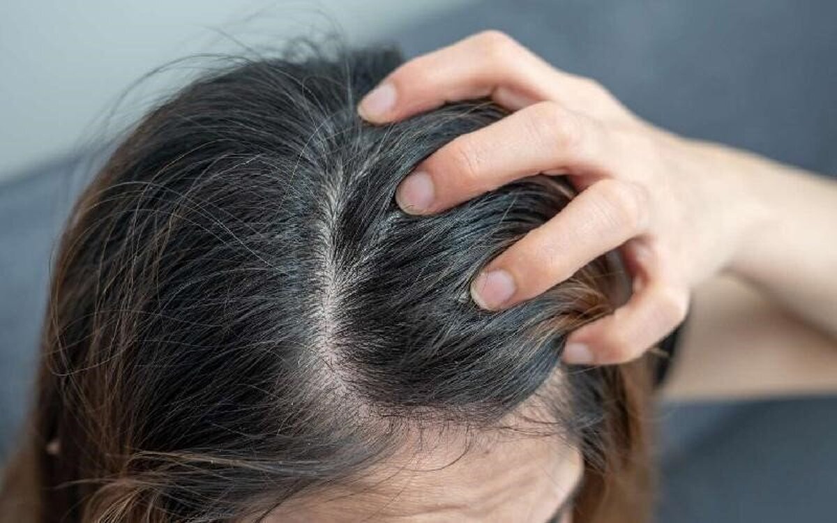اگر خارش پوست سر امانتان را بریده بخوانید!