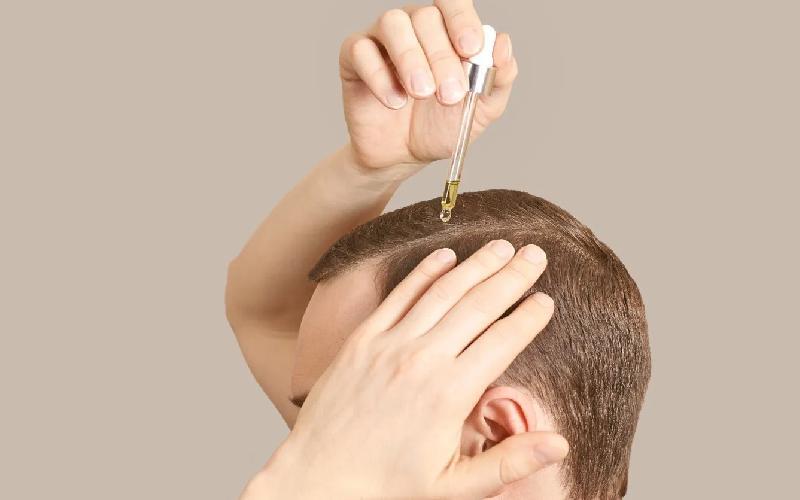 اگر خارش پوست سر امانتان را بریده بخوانید!