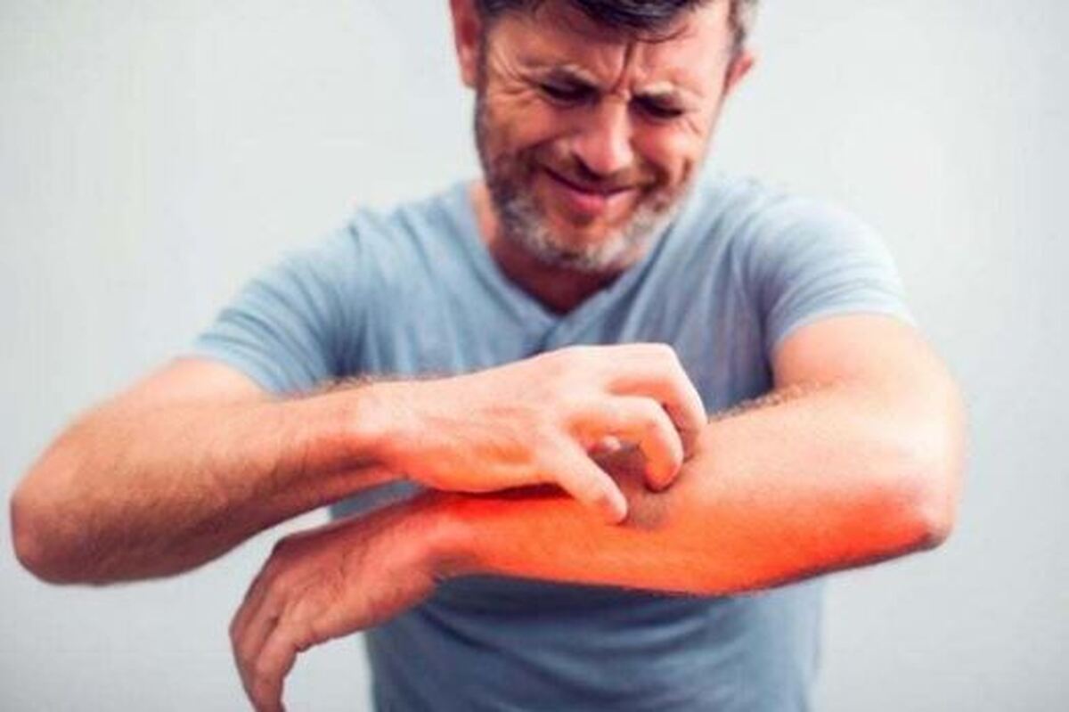 بررسی مکانیسم خاراندن