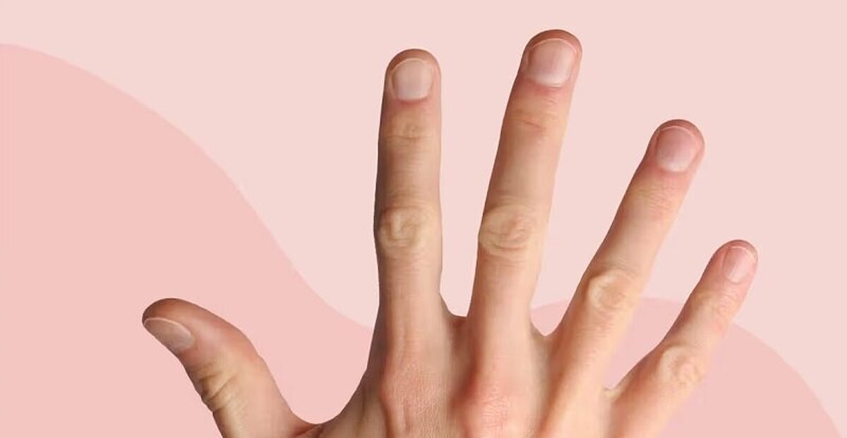 برجستگی و فرورفتگی‌های ناخن درمورد سلامت شما چه می‌گوید؟