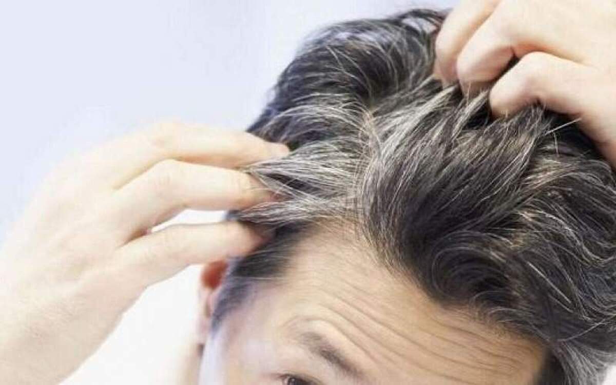 چه عواملی موهایتان را زودتر سفید میکند؟