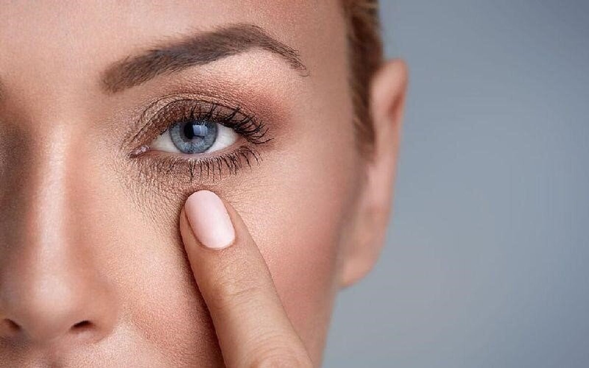 علل ریشه‌ای که باعث سیاه شدن زیر چشم می‌شود/از کم خوابی تا آلرژی
