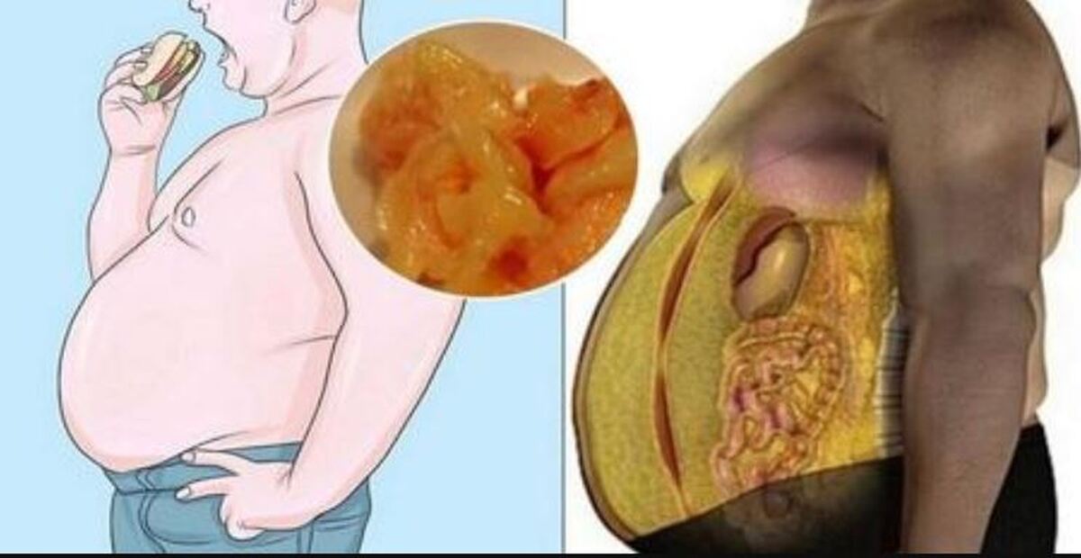 این مواد غذایی را در رژیم تان قرار دهید و از شر چربی‌های اضافه شکمی خلاص شوید