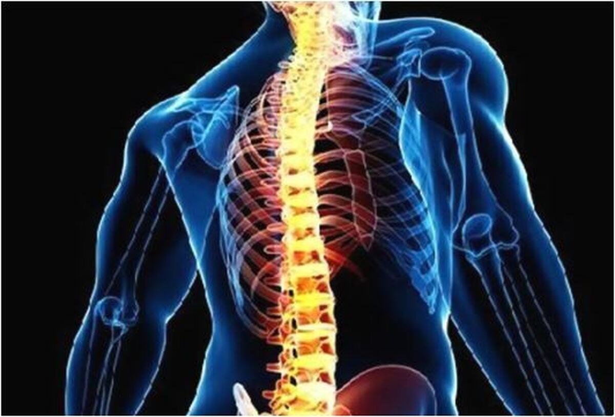 توصیه‌های مهم برای جلوگیری از بروز مشکلات ستون فقرات