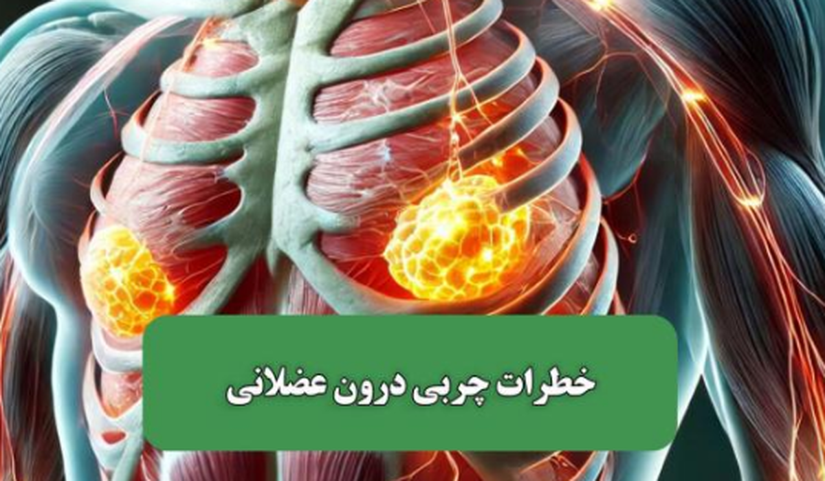 چربی درون‌عضلانی عاملی برای ابتلا به دیابت نوع دو!