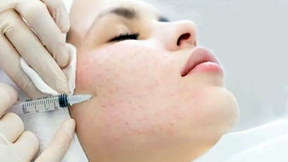 استفاده از مزوتراپی در این مراکز ممنوع!