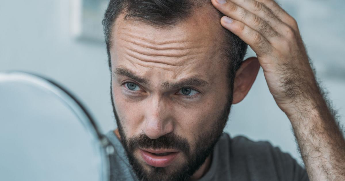 مو‌های از دست رفته را با این قرص برگردانید!