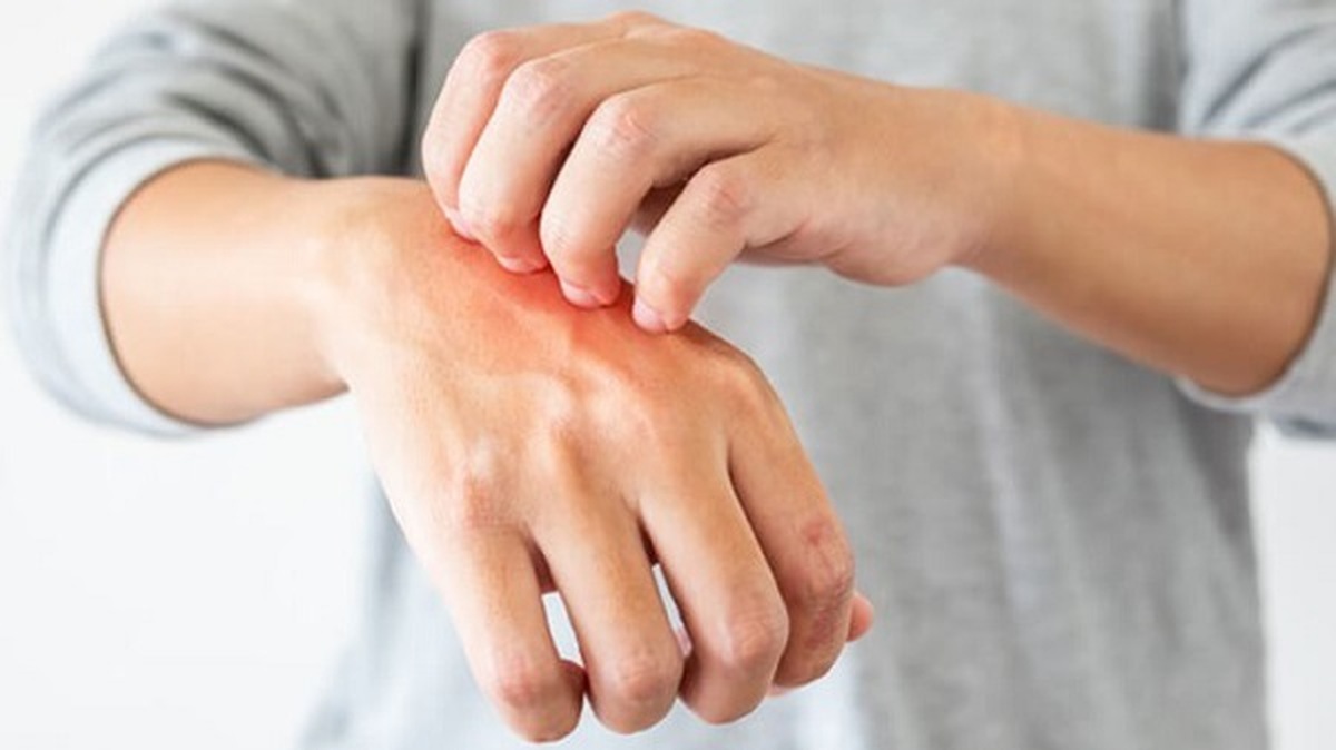 آلرژی غذایی به چه دلیلی رخ میدهد؟
