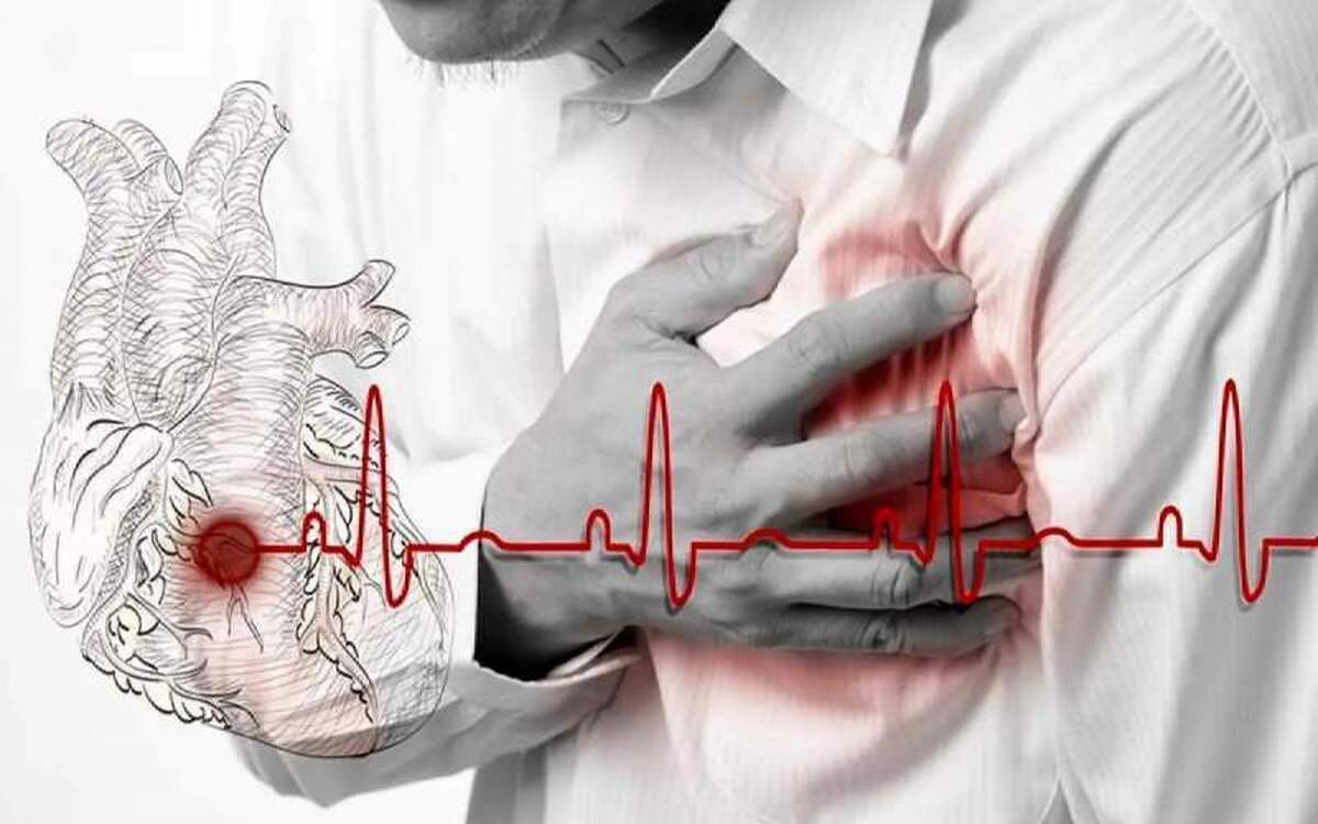 سردی هوا و فراهم سازی شرایط سکته‌های قلبی