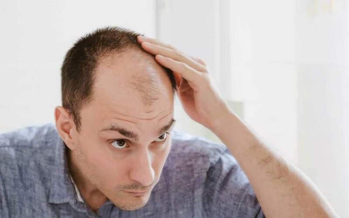 این ۵ مورد بلای جان موهایتان هستند!