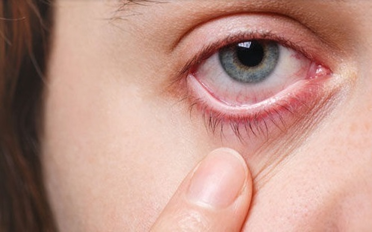 سرطان شبکیه چشم چیست؟ با چه علائمی ظاهر میشود؟