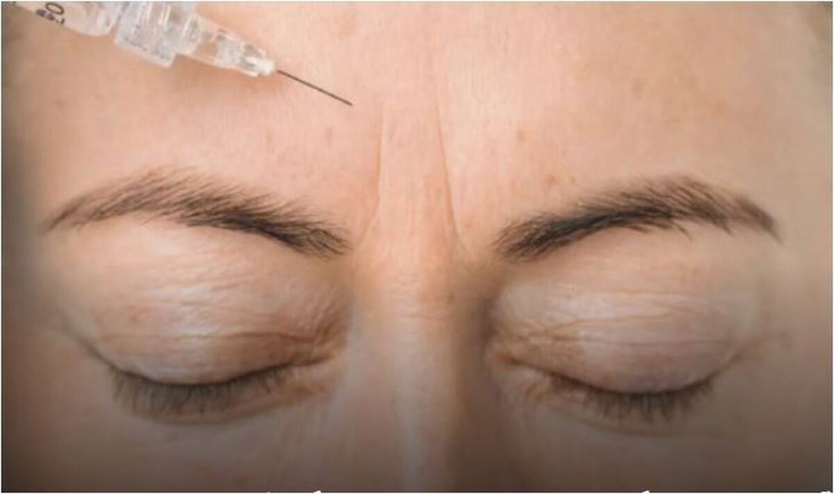 درمان چین و چروک با روش‌های خانگی موثر است؟