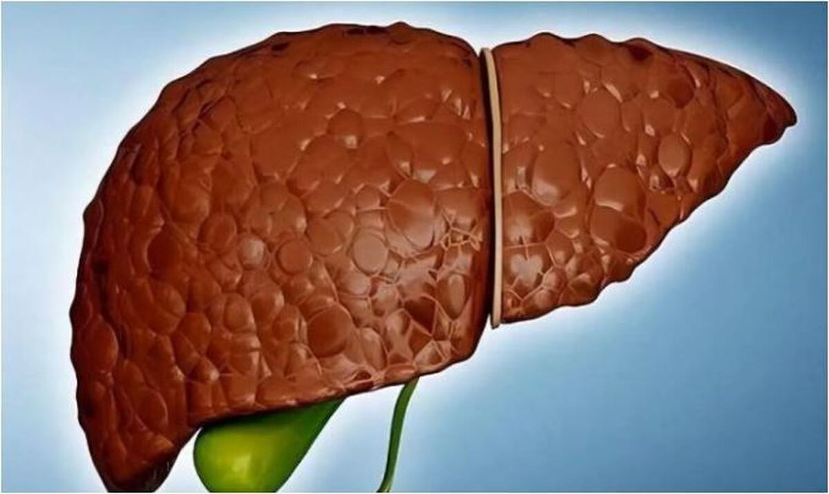 رهایی از کبد چرب با این خوراکی‌های در دسترس