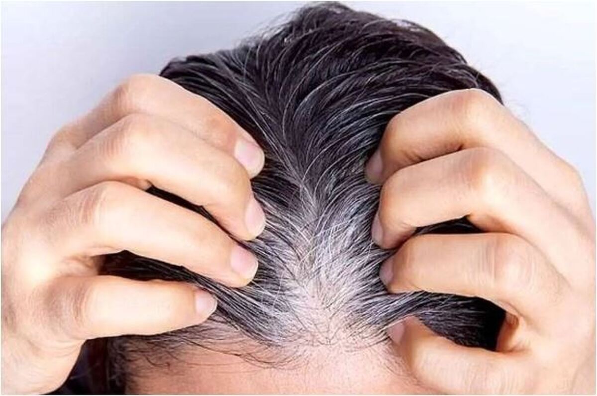 چگونه از سفید و خاکستری شدن مو‌ها جلوگیری کنیم؟