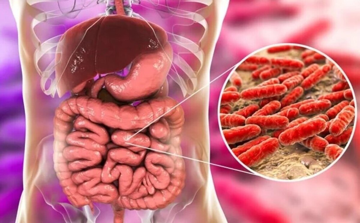 چی بخوریم سرطان روده نگیریم؟
