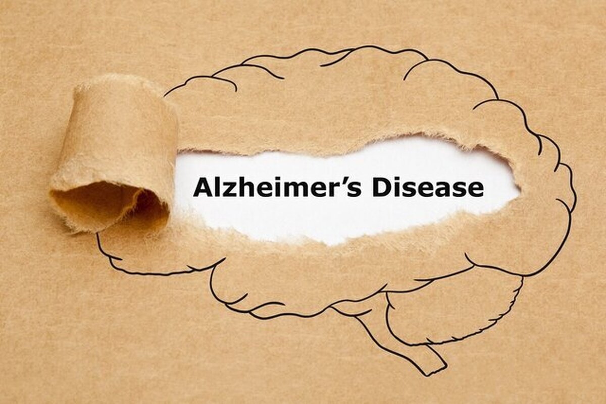 معکوس کردن آلزایمر چگونه انجام میشود؟